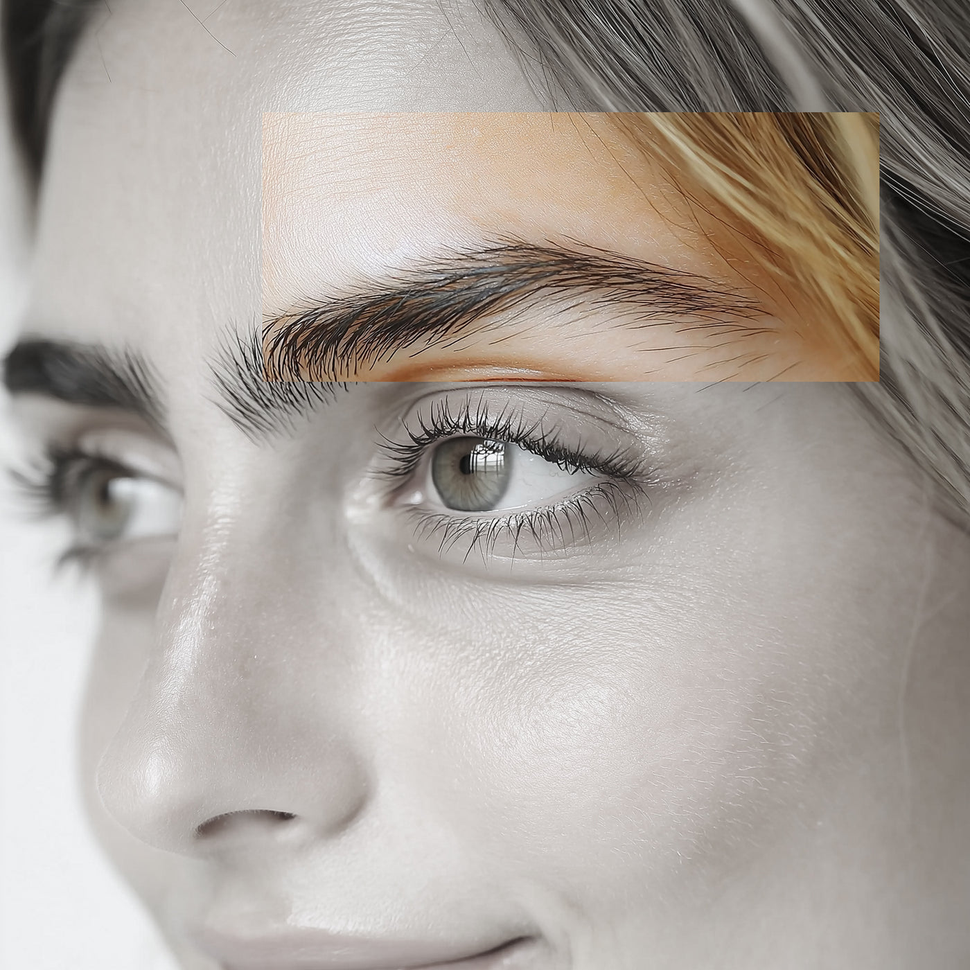 Brow Lift